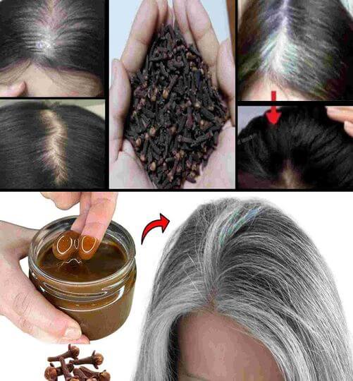 On the 15th day, the gray hair had completely disappeared 