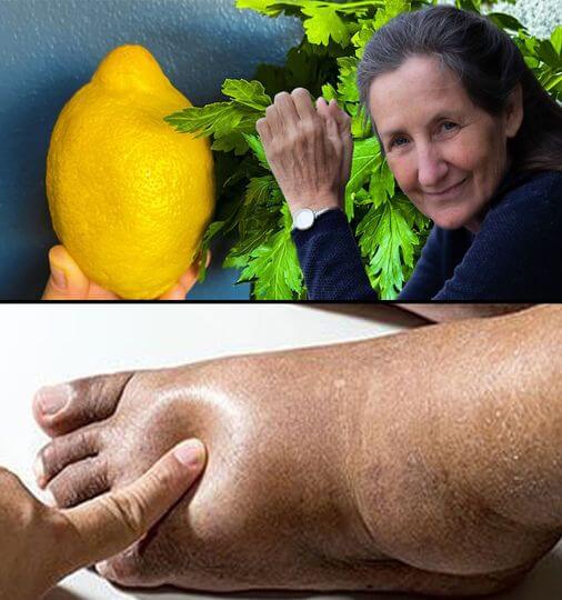 Eliminate excess water from the body promptly to prevent swelling in the hands and feet 