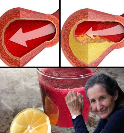 Reverse Clogged Arteries and Lower High Blood Pressure: Only a Glass of this Juice