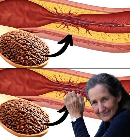 1 tablespoon a day: prevents blood clots, stroke and heart attack