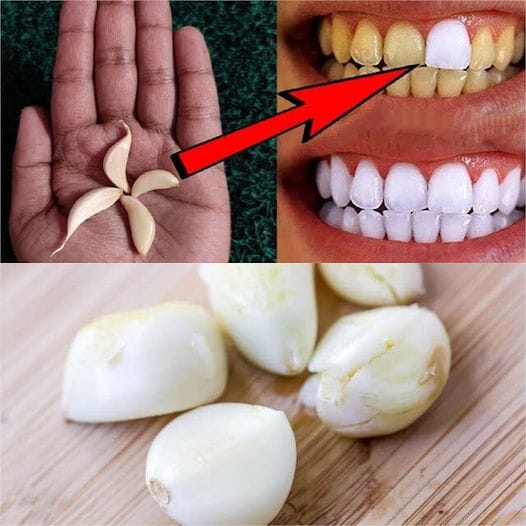 Unlock the Secret to a Brighter Smile with Garlic 1