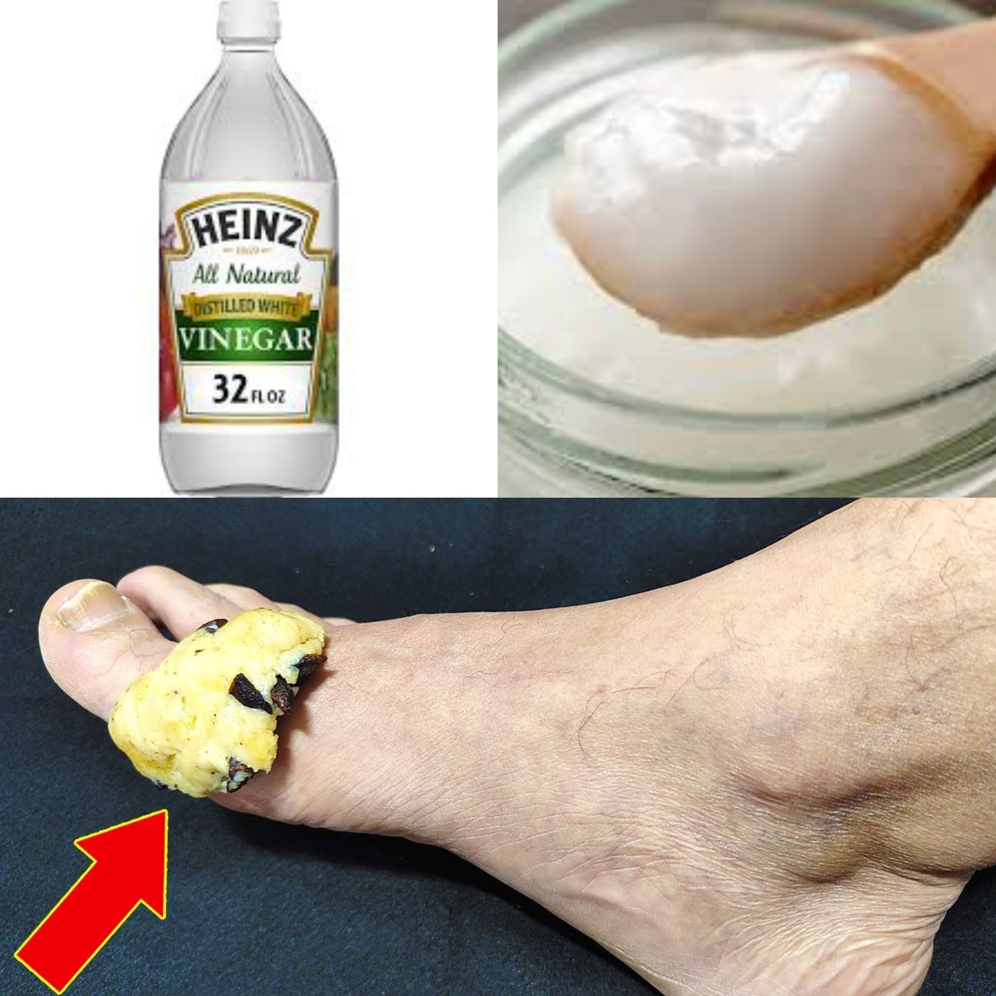 Save money at the pharmacy by just putting it on your feet 3