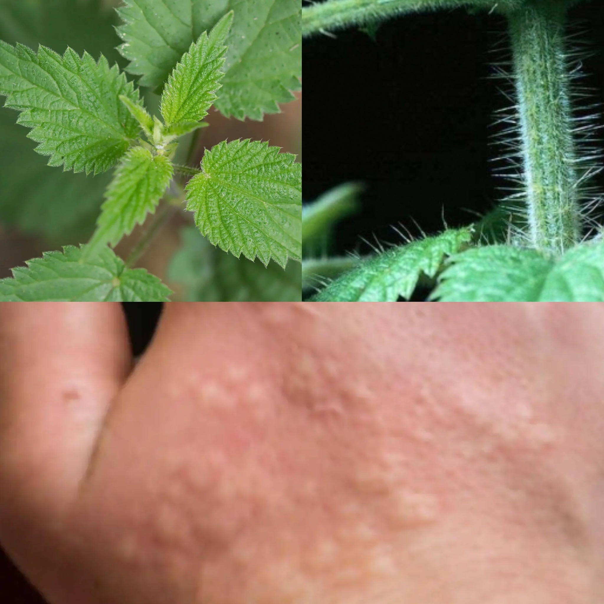 Revealing the Nutritious Powerhouse of Stinging Nettle 1