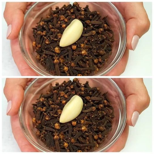 Due to leg pain and varicose veins 1