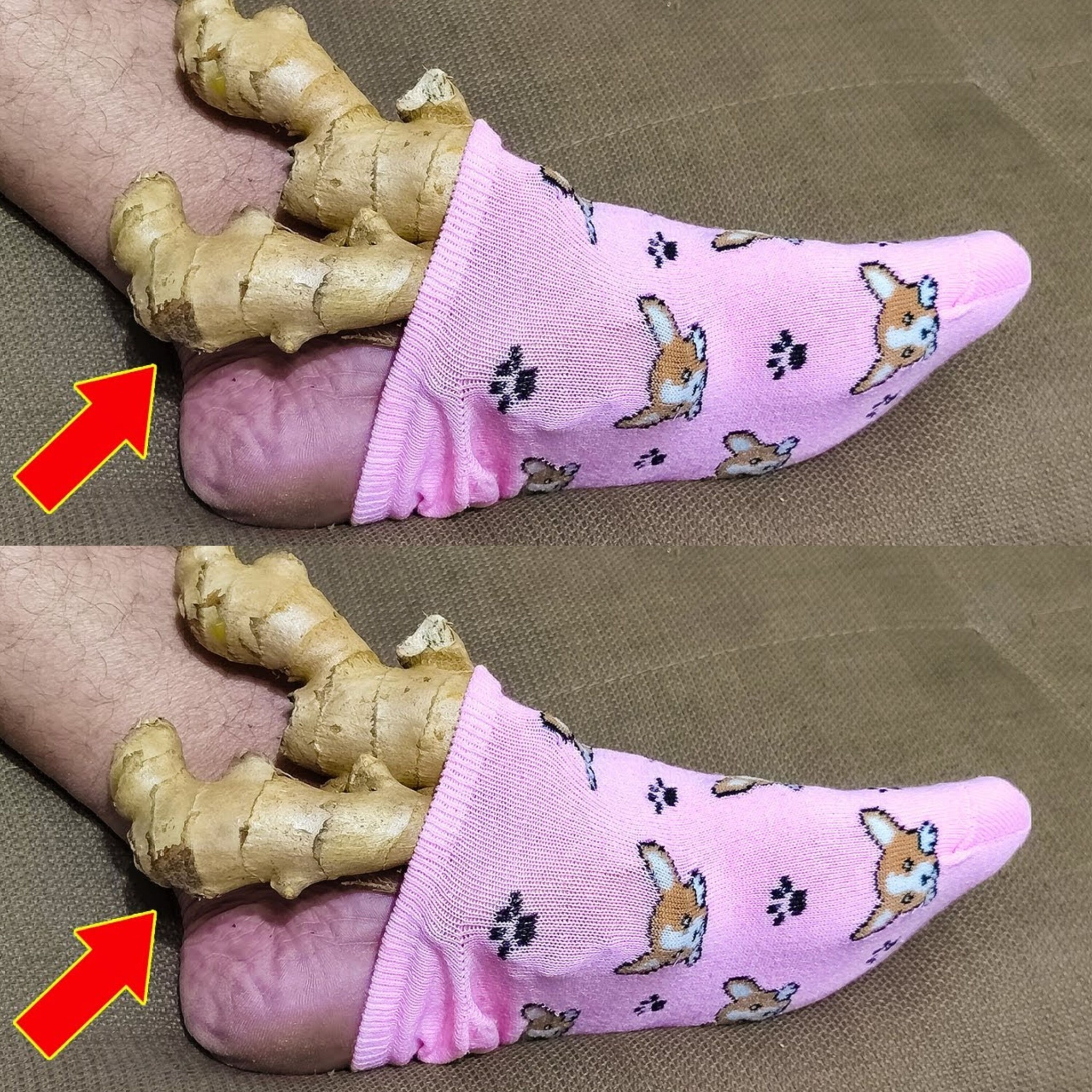 Put 1 Ginger on Your Feet 5