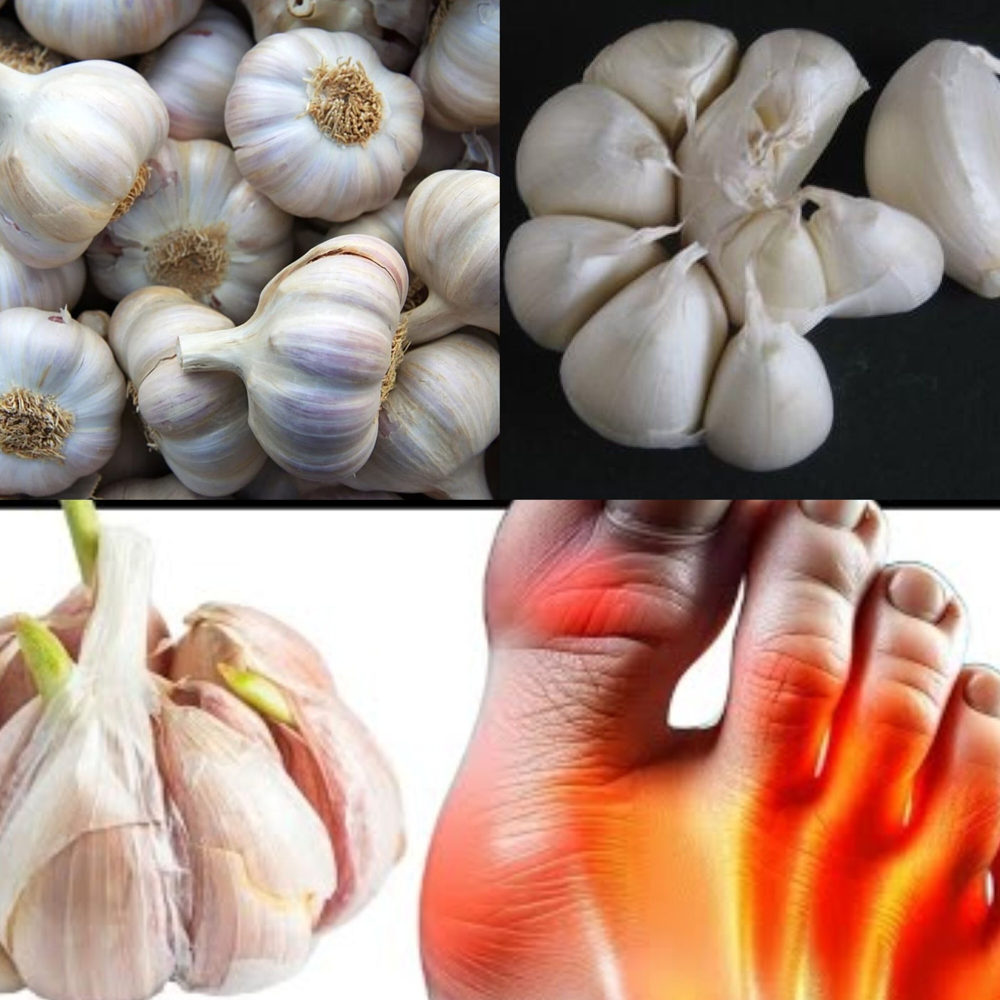 Garlic Gets Rid of Gout 2