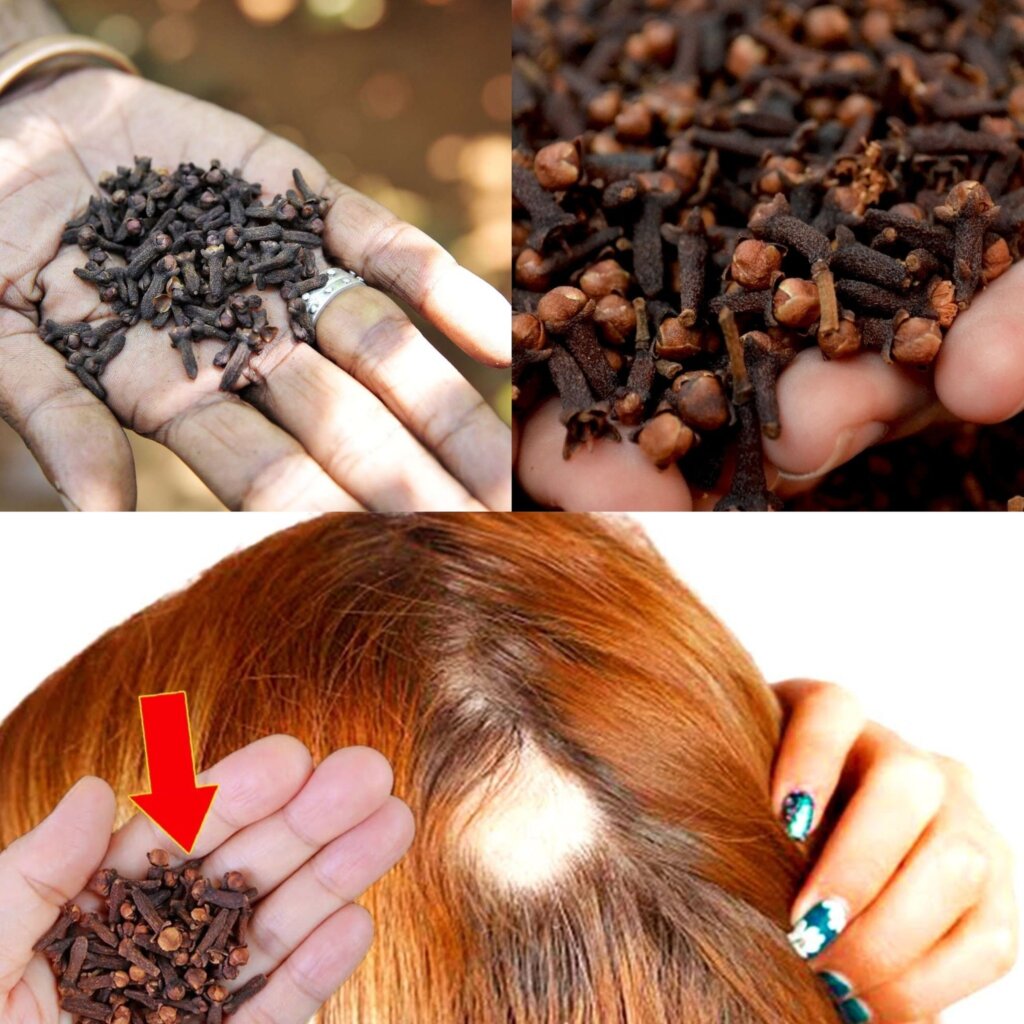 Here's Why You Should Put Cloves In Your Hair Instead Of Buying Drugs