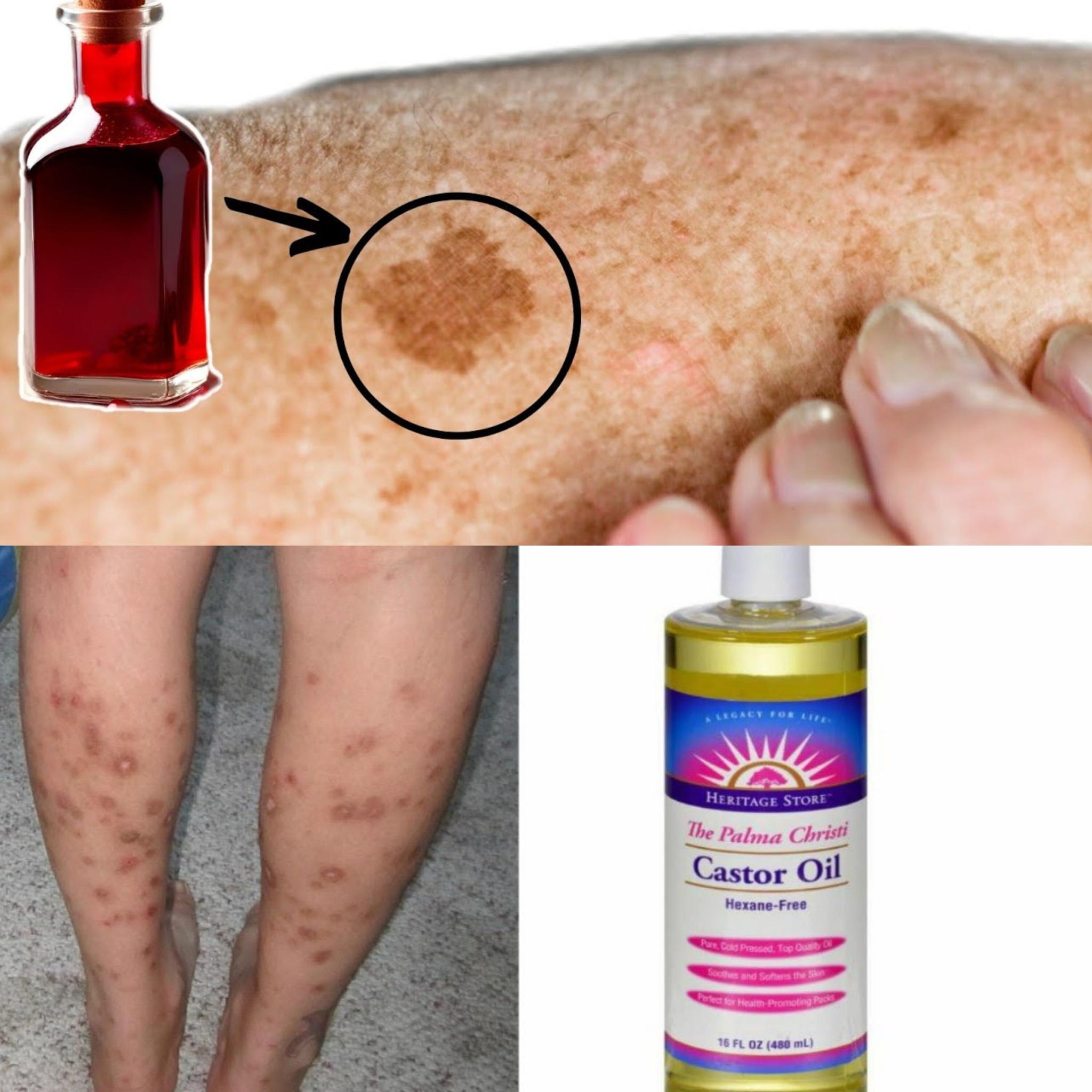 The Miraculous Oil That Erases Age Spots Overnight 7