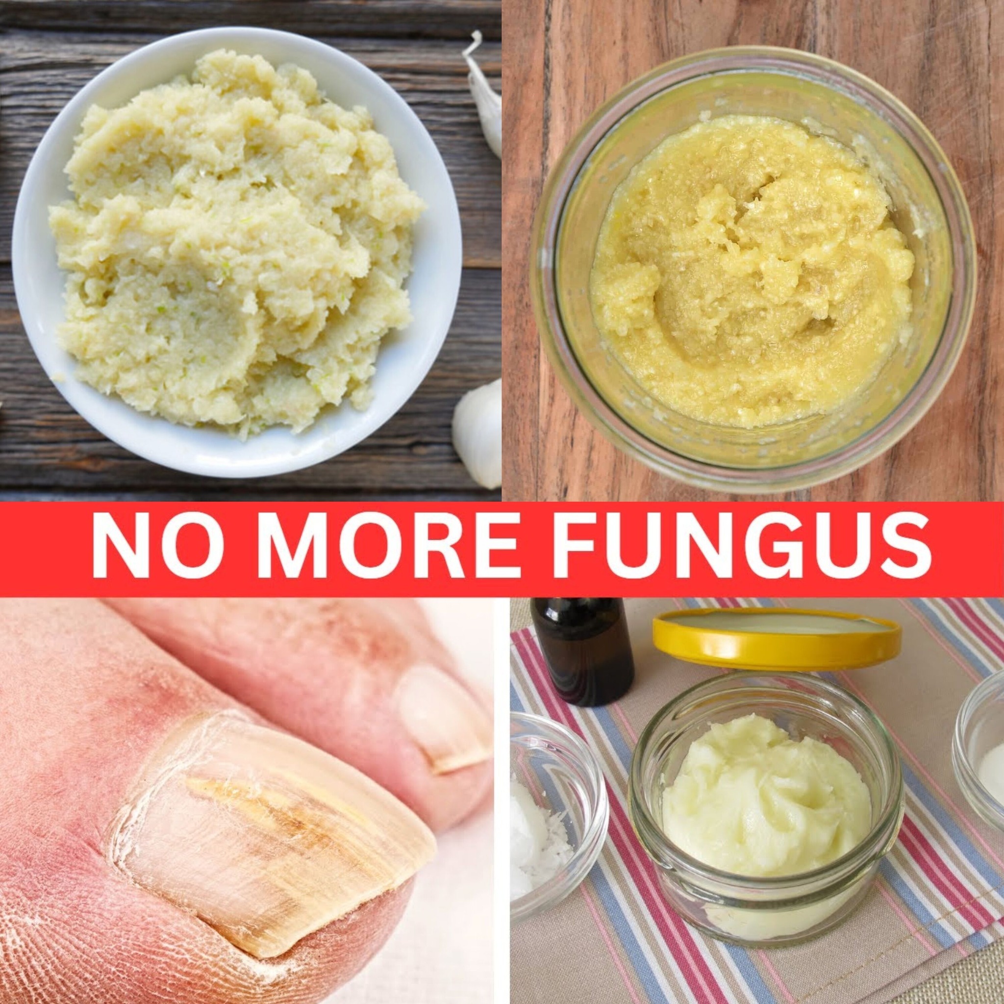 The Secret to Banishing Toenail Fungus for Good 1