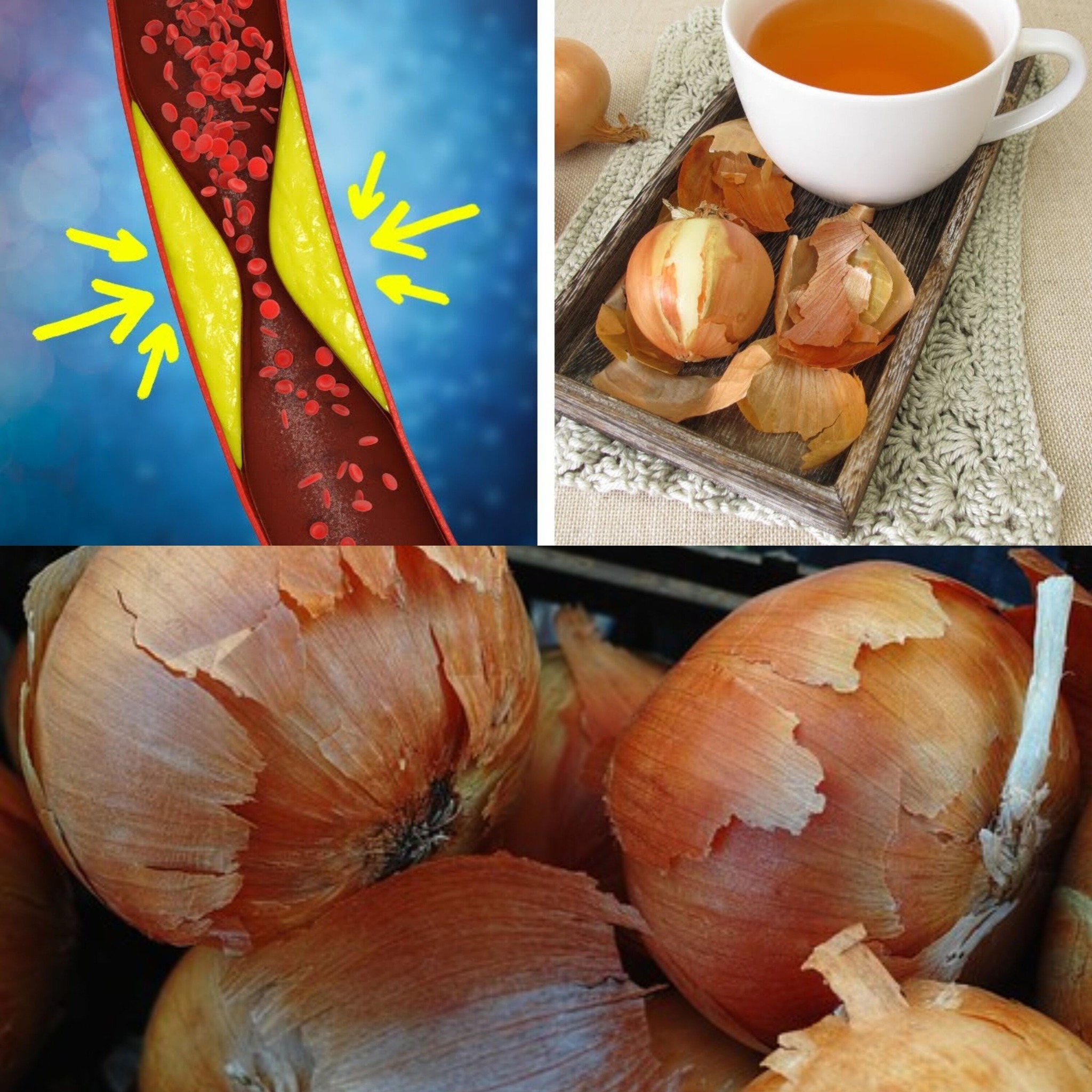 You Won’t Believe What Onion Peels Can Do For Your Health 1