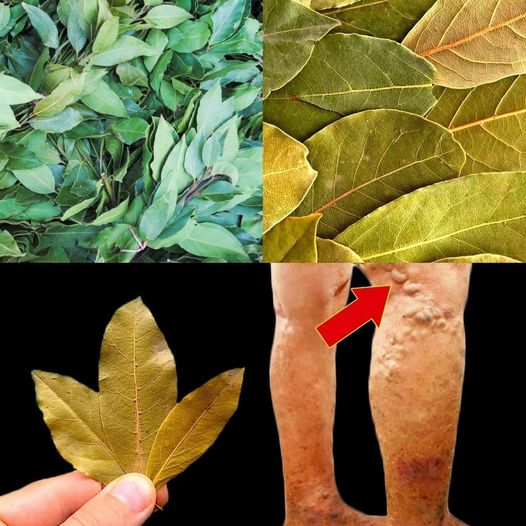 Use bay leaves and don't spend any more money at the pharmacy 1