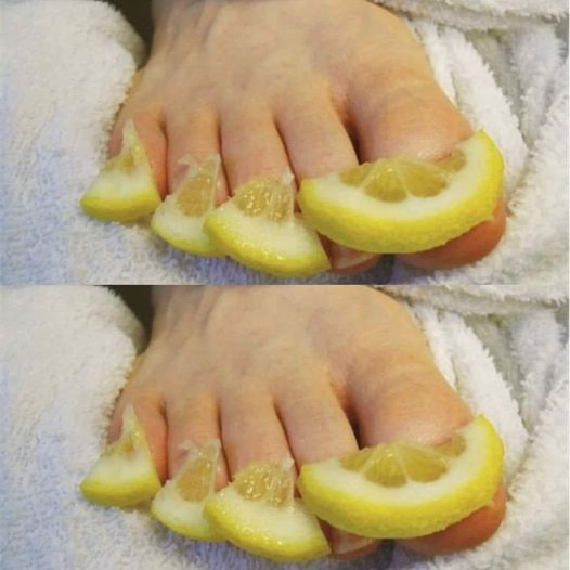 This is going to ruin your toenail. 1