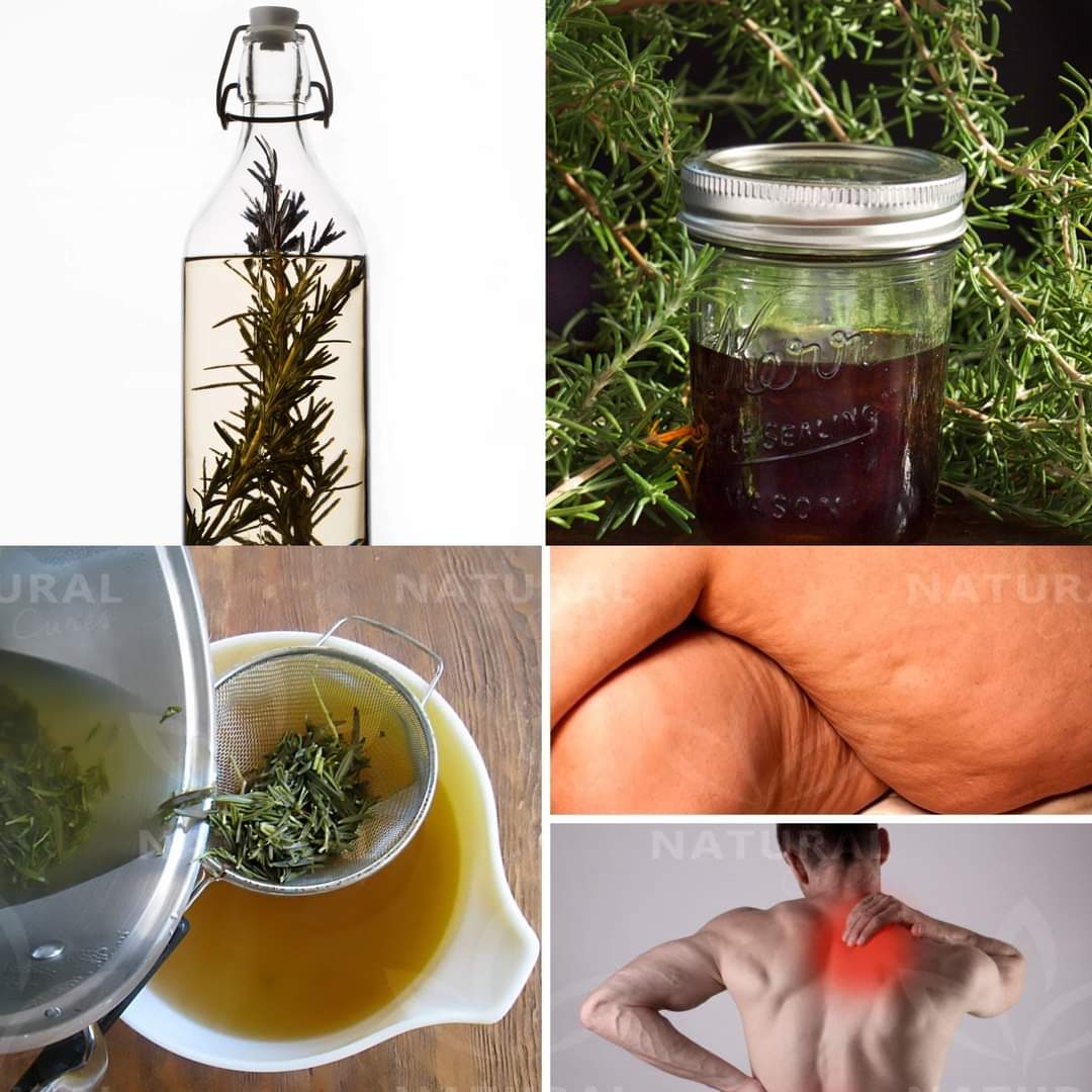 Use Rosemary Alcohol to Get Rid of Cellulite and Muscle Pain 1