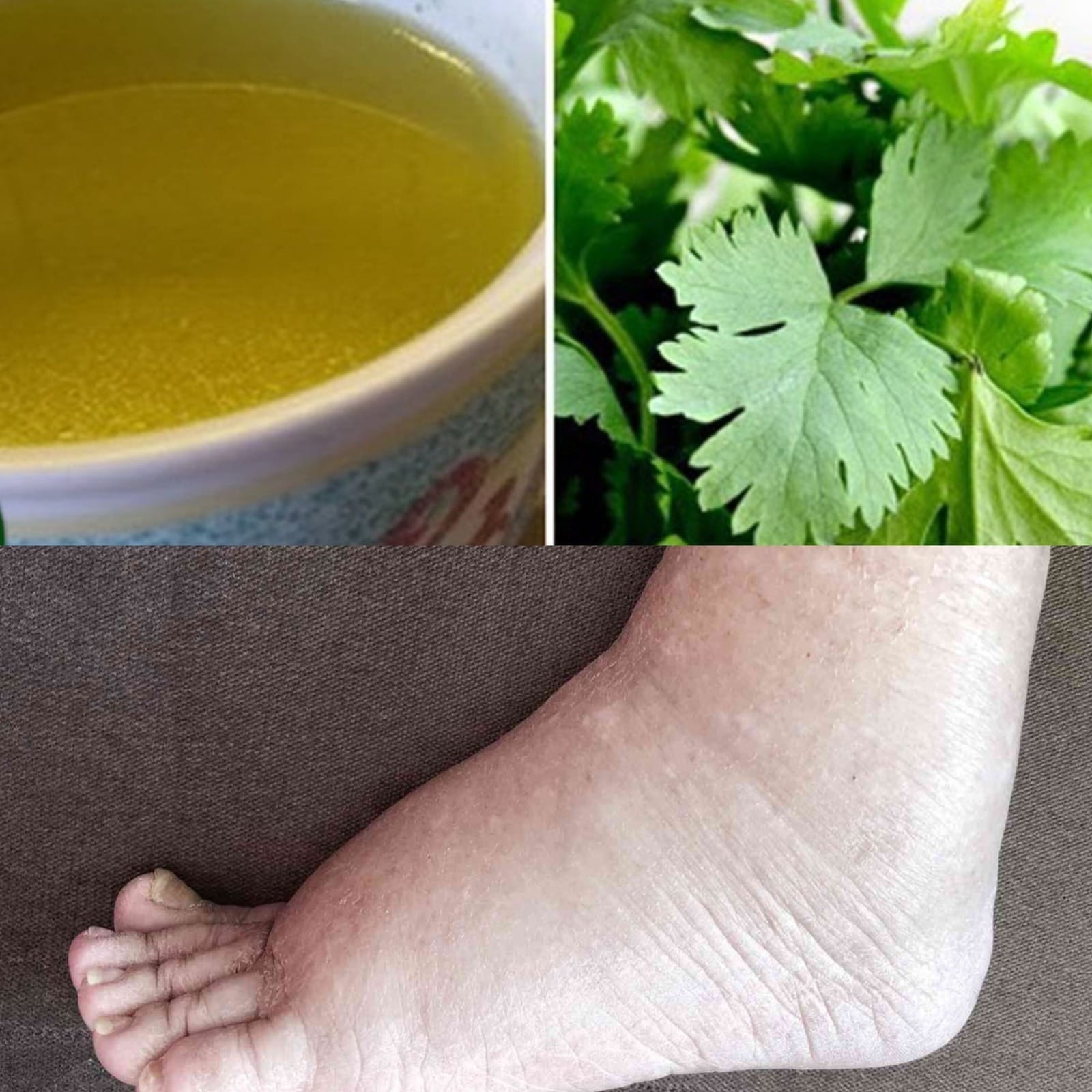 Weight Loss home remedy 1