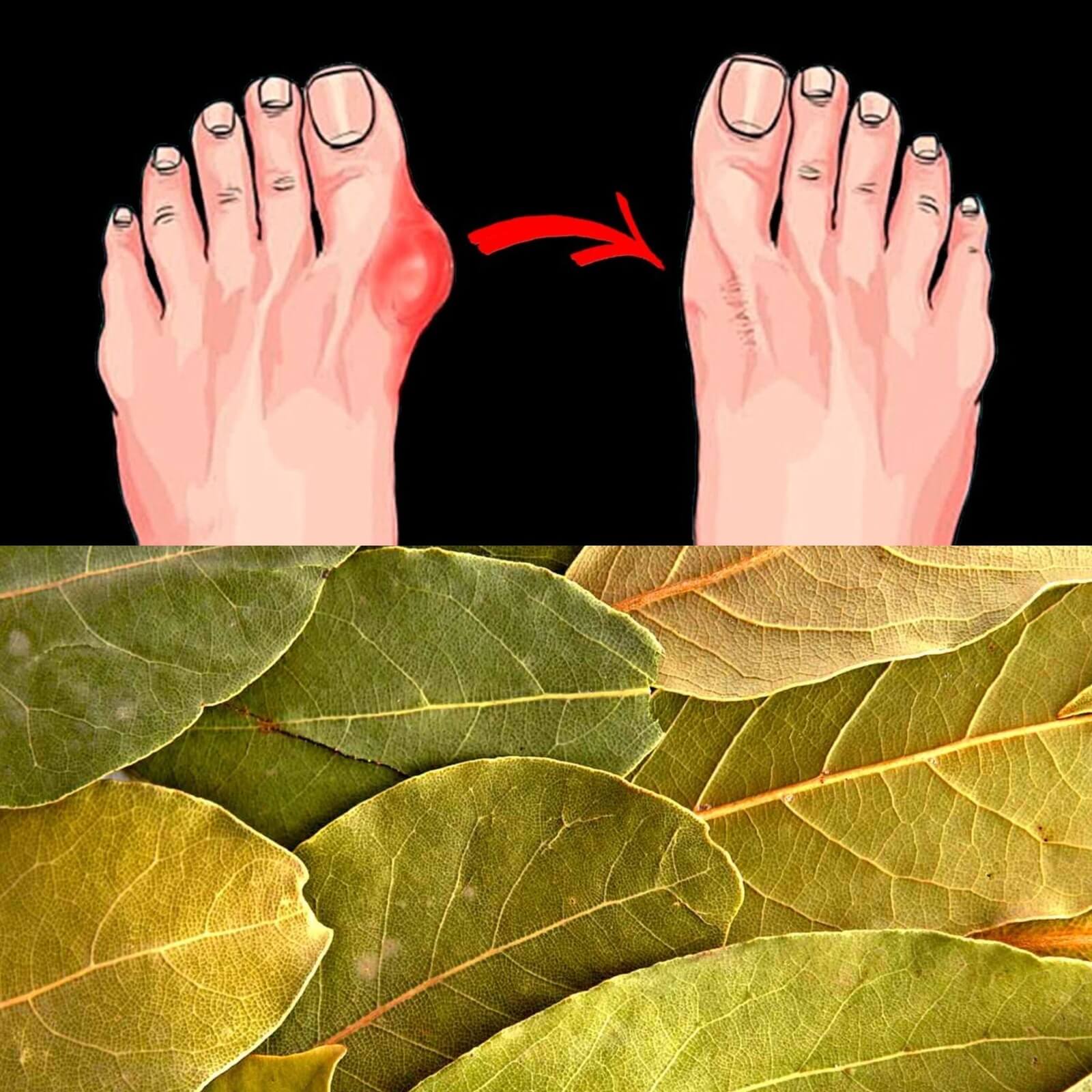 Using Bay Leaves for Healthy Feet 9