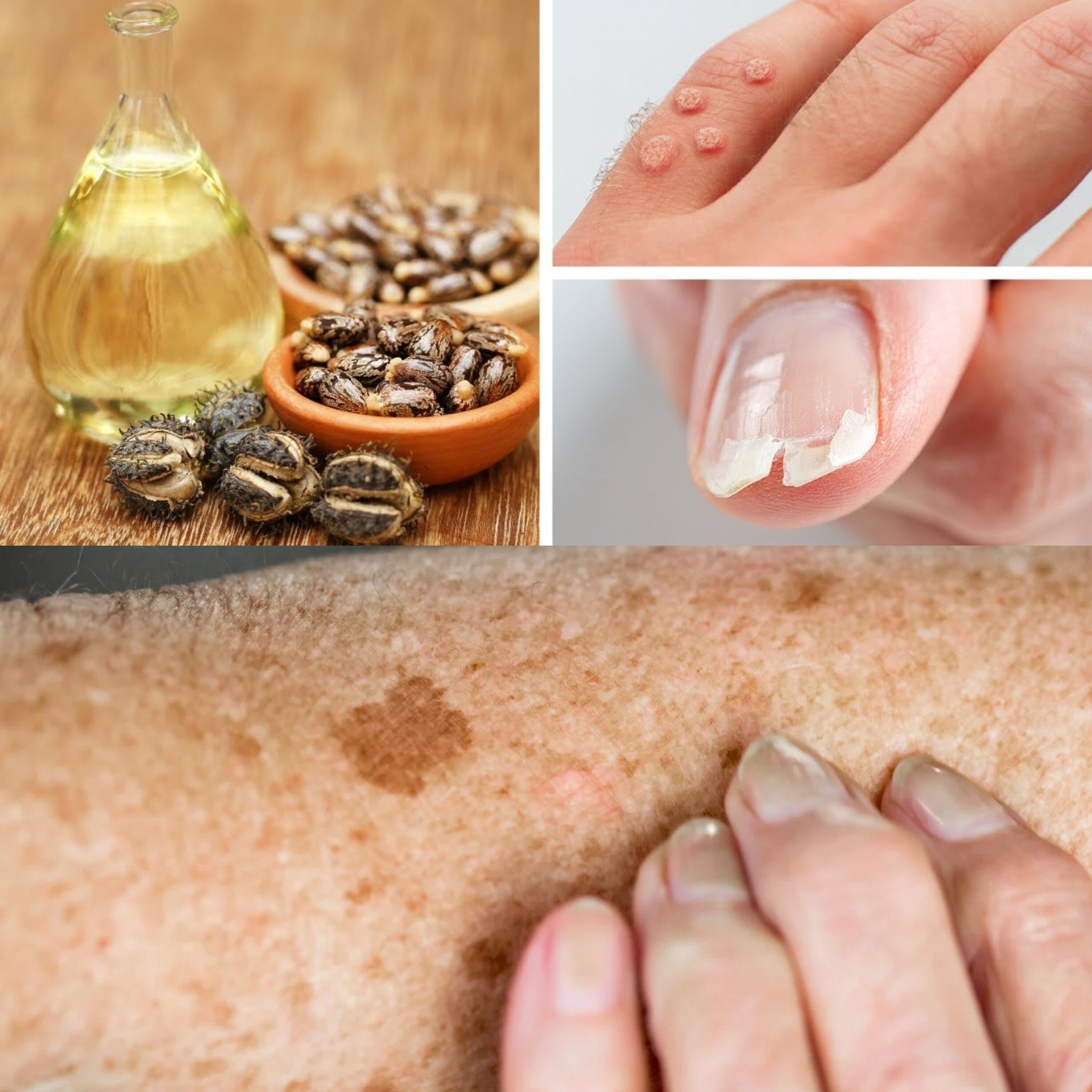 Few People Are Aware of These Unexpected Applications for Castor Oil 1