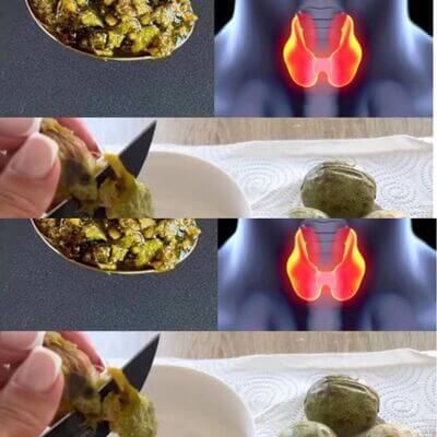 Taking Care of Your Thyroid with Green Walnuts and Honey 8