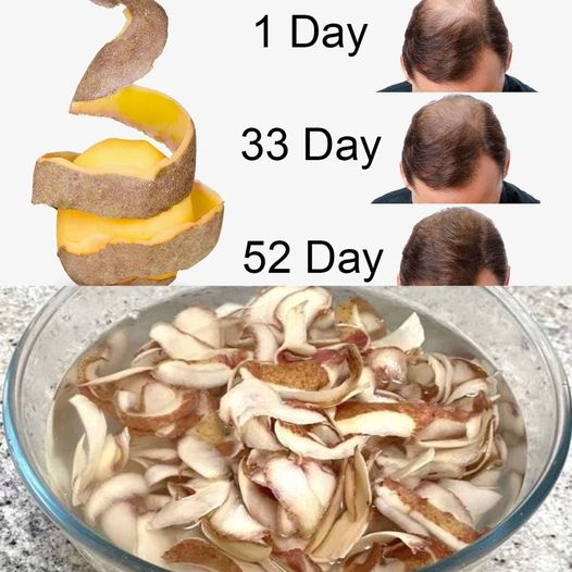 Potato peels are to blame for the insane growth of hair on my bald spot. 1