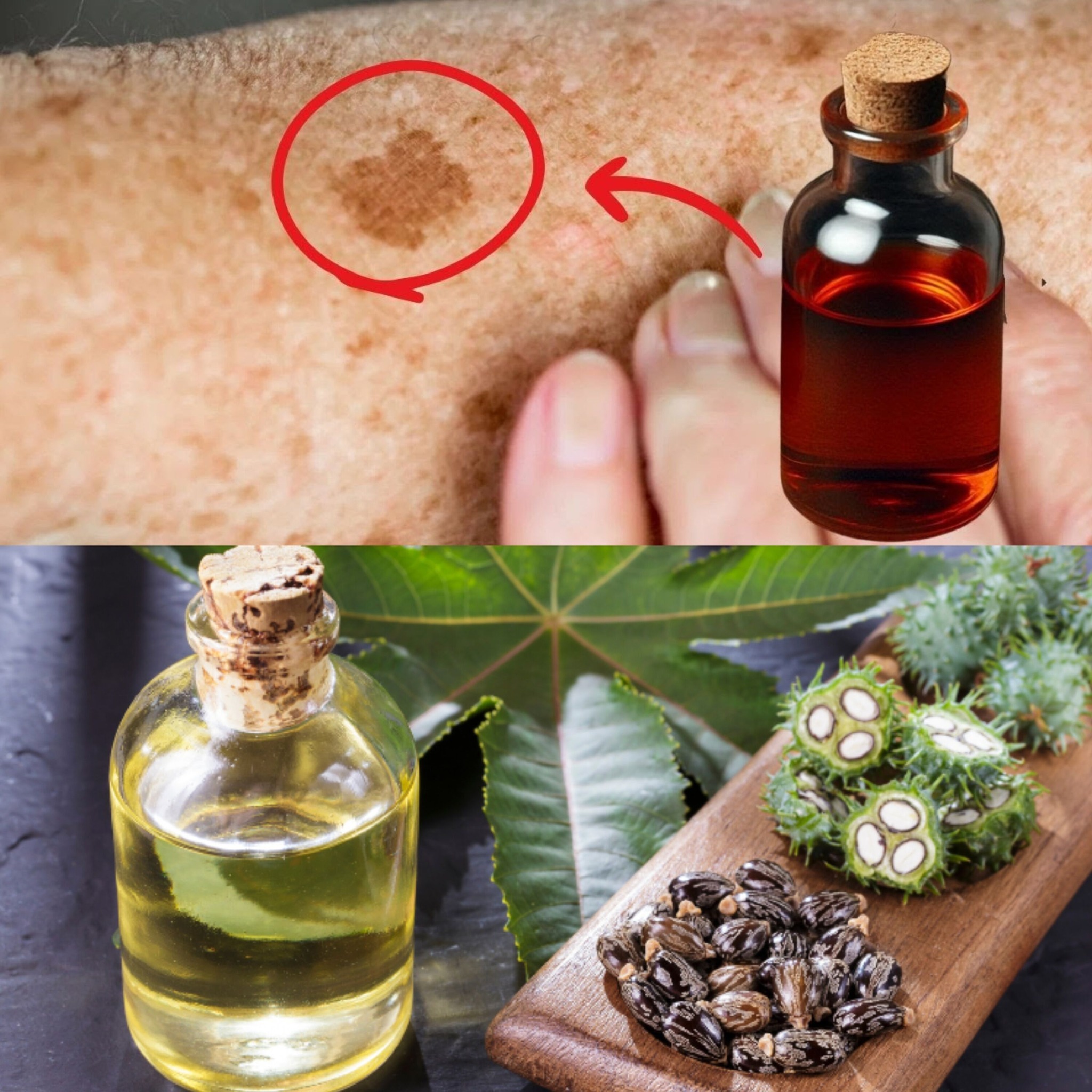 Erase Your Chalazion: Is Castor Oil The Answer? - unbkqgg