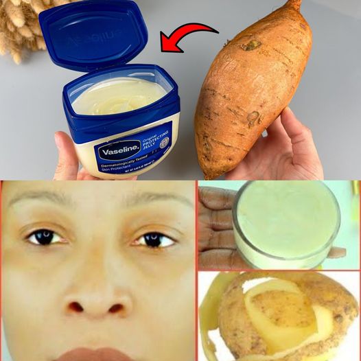 You'll love the combination of Vaseline and sweet potatoes 1