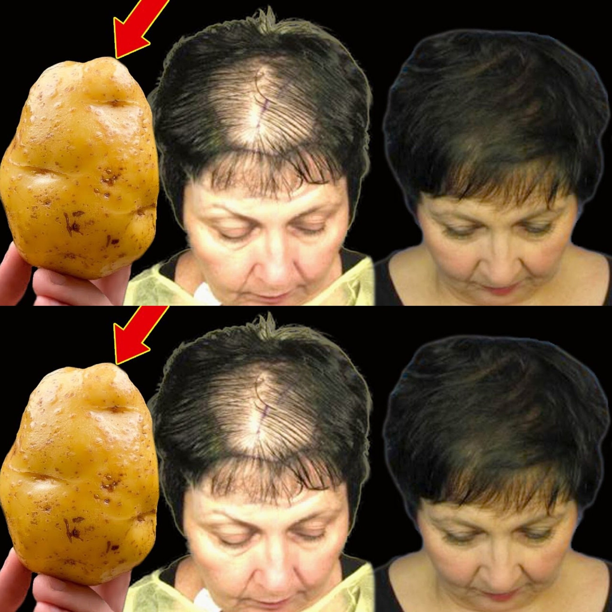 Unlock Rapid Hair Growth with This Powerful Potato Recipe! 1