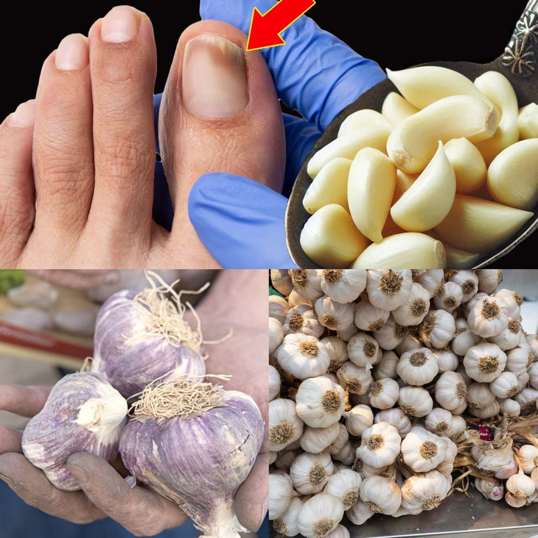 This is a Nail Fungus Killer (It Works Very Fast): Garlic 1