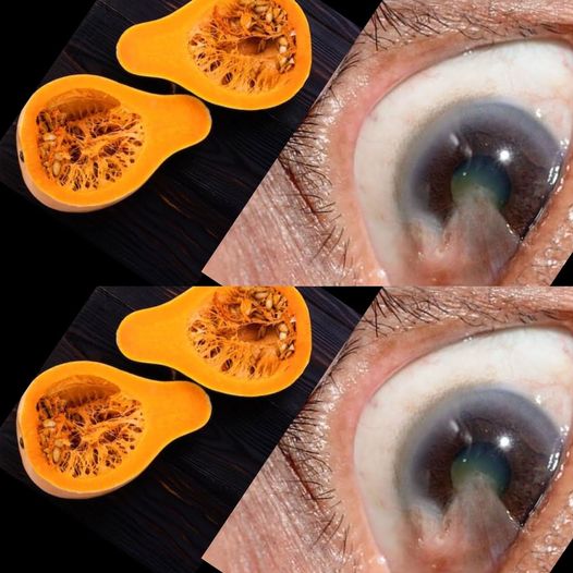 The Surprising Power of Pumpkin: A Personal Journey to Improved Eyesight 1