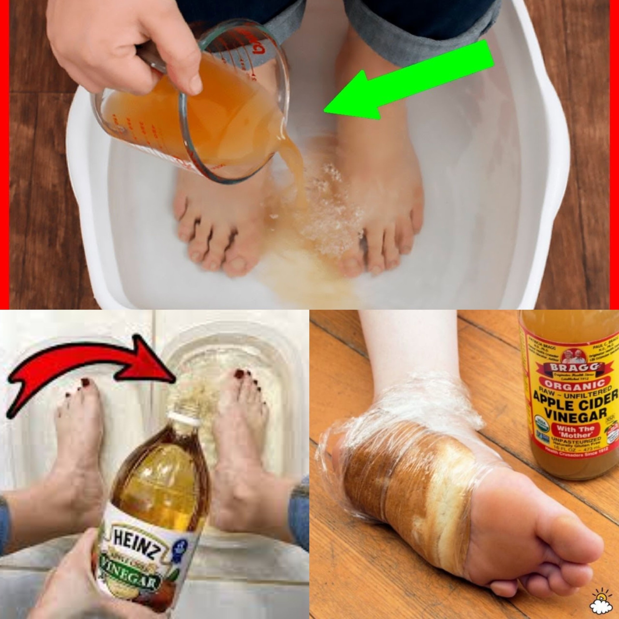 Make Your Own Apple Cider Vinegar Detox Soak to Rejuvenate Your Feet 1