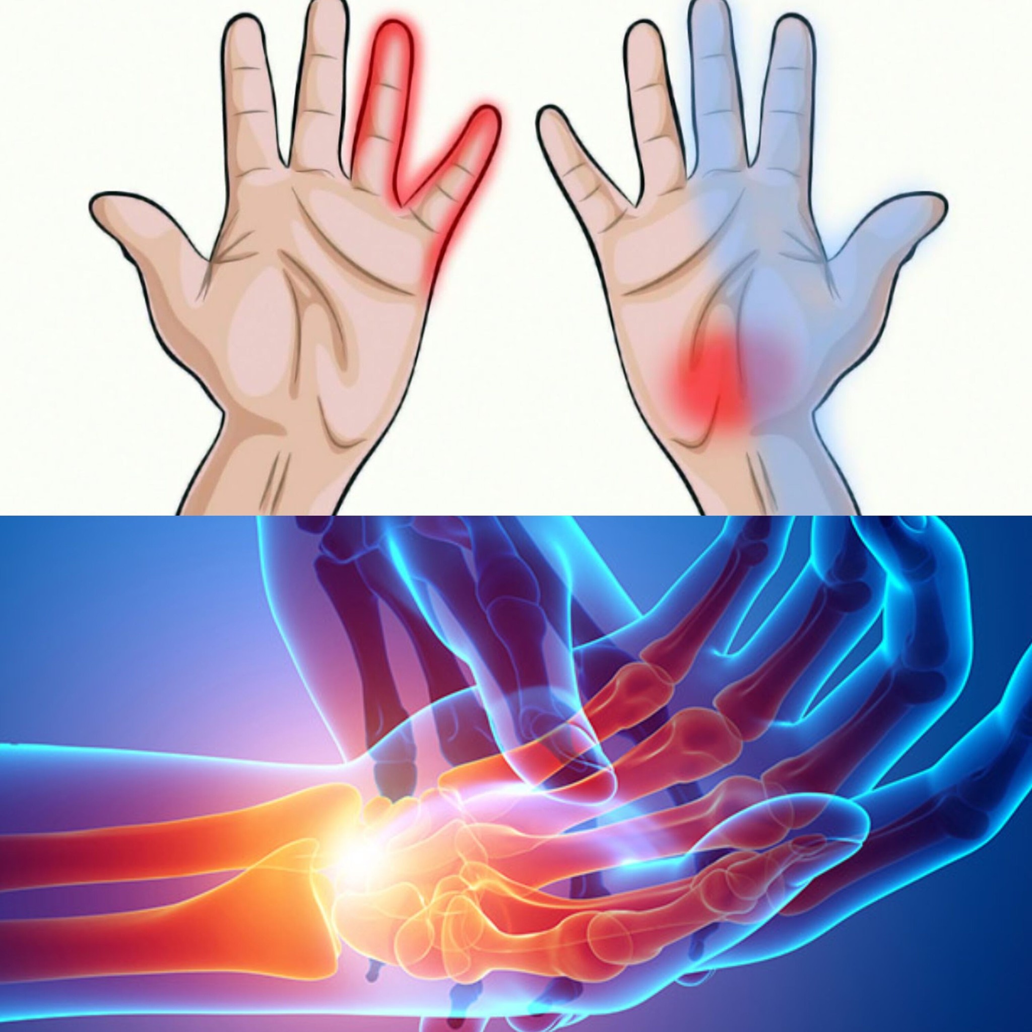 "7 Health-Related Insights Your Hands Can Provide" 1