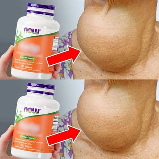 Beware! These Popular Supplements Are Harming Your Thyroid 1