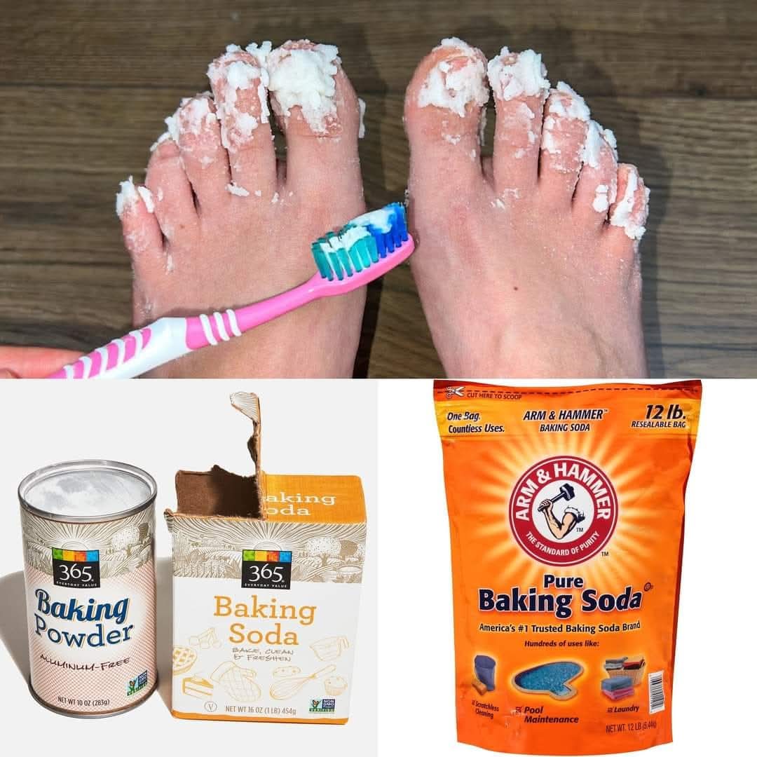 Simple Home Remedy for Nail Fungus Baking Soda 1
