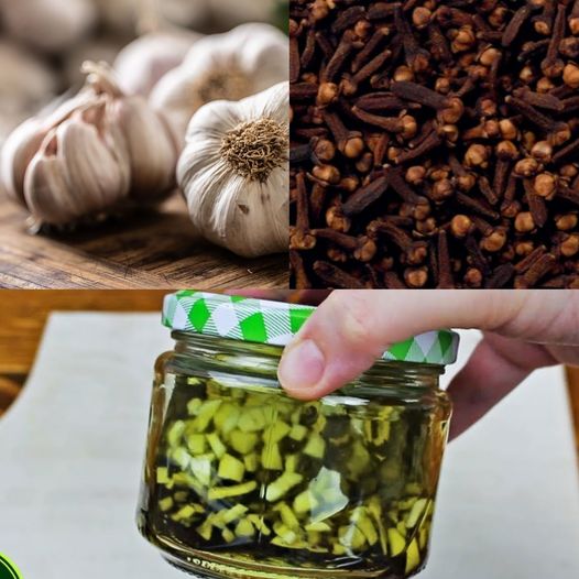 Varicose Veins Natural Remedy 1