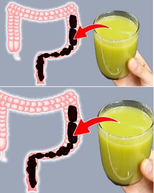 Embarking on a 7-Day Colon Cleanse for Weight Loss 1
