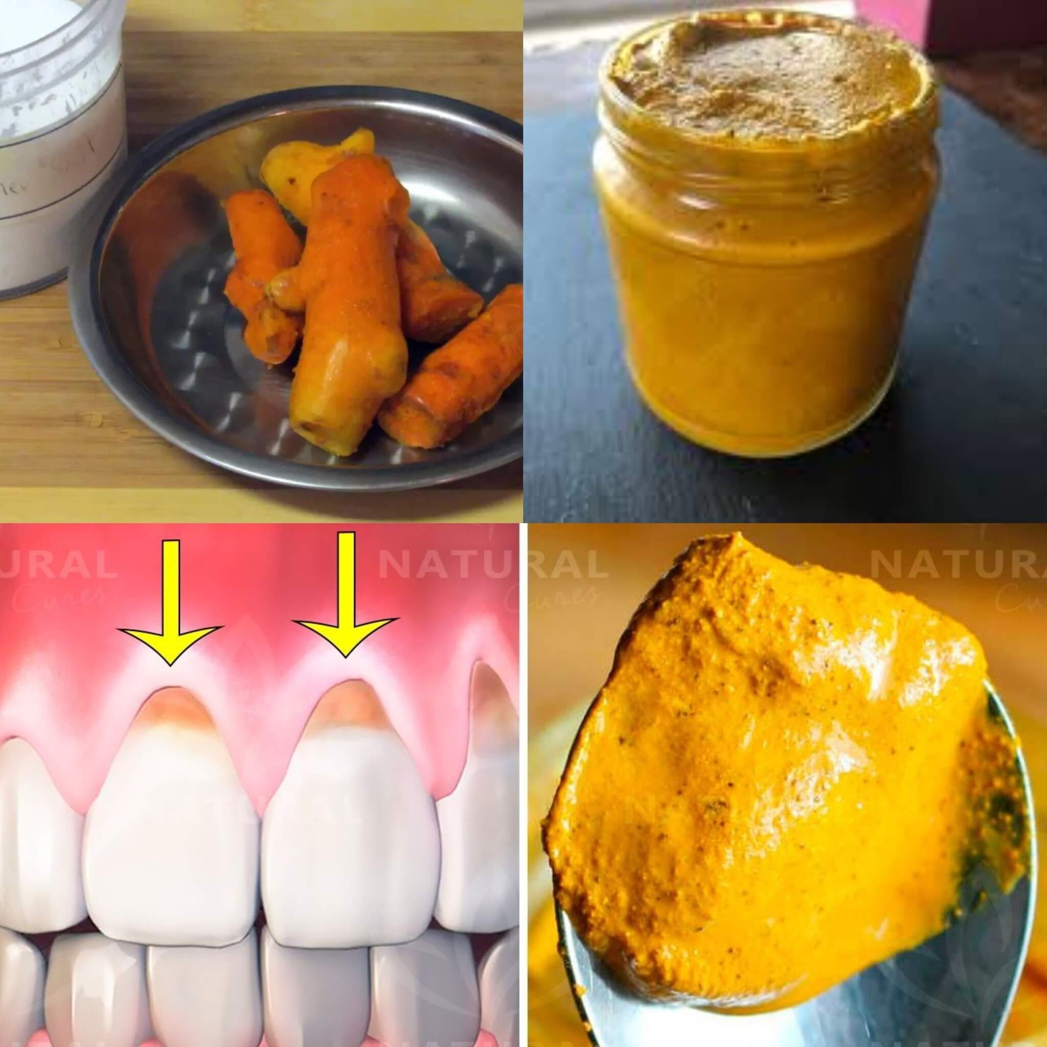 The Great Benefits of Turmeric for Dental Health and Hygiene 1