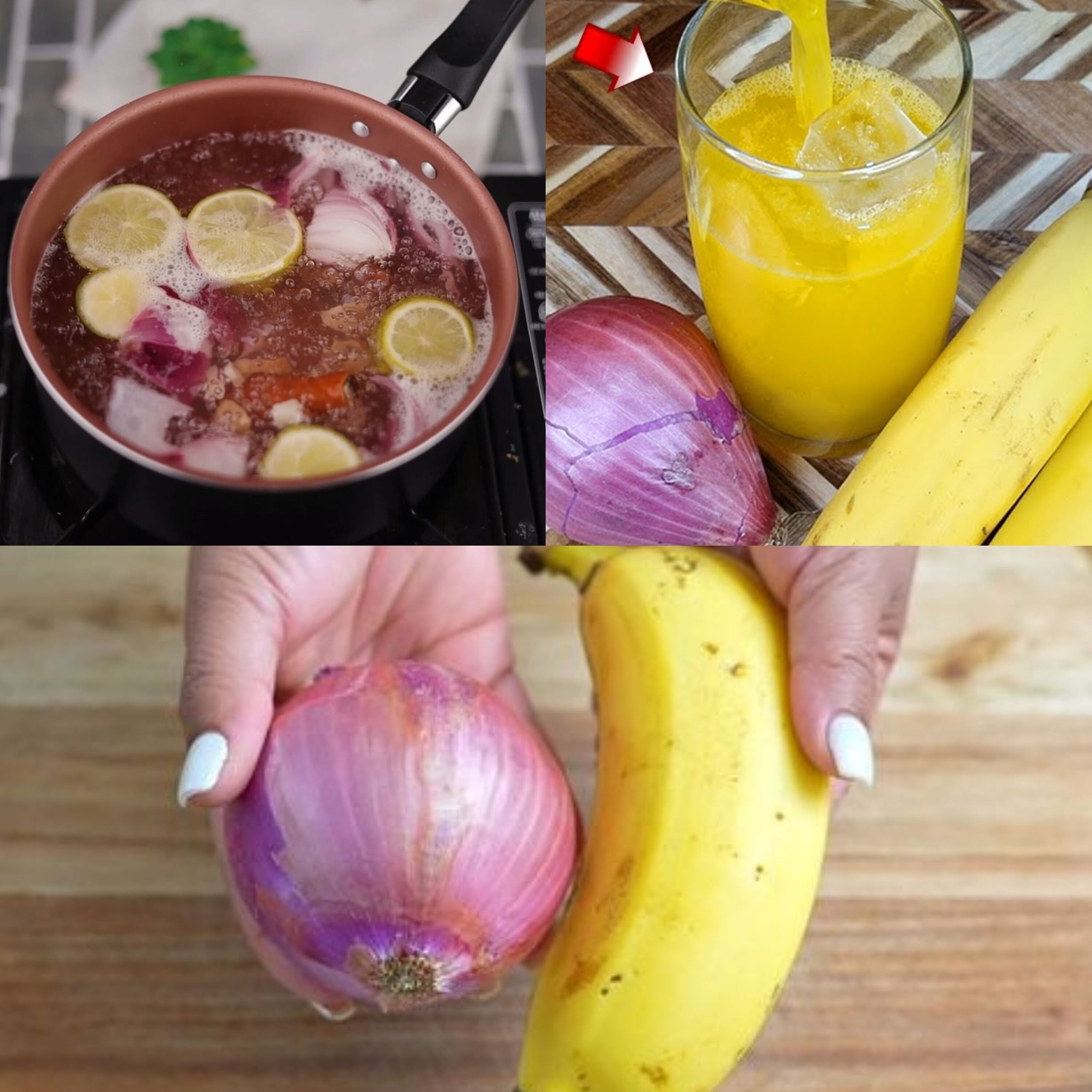 An Onion and Banana Treatment for Joint Pain 1