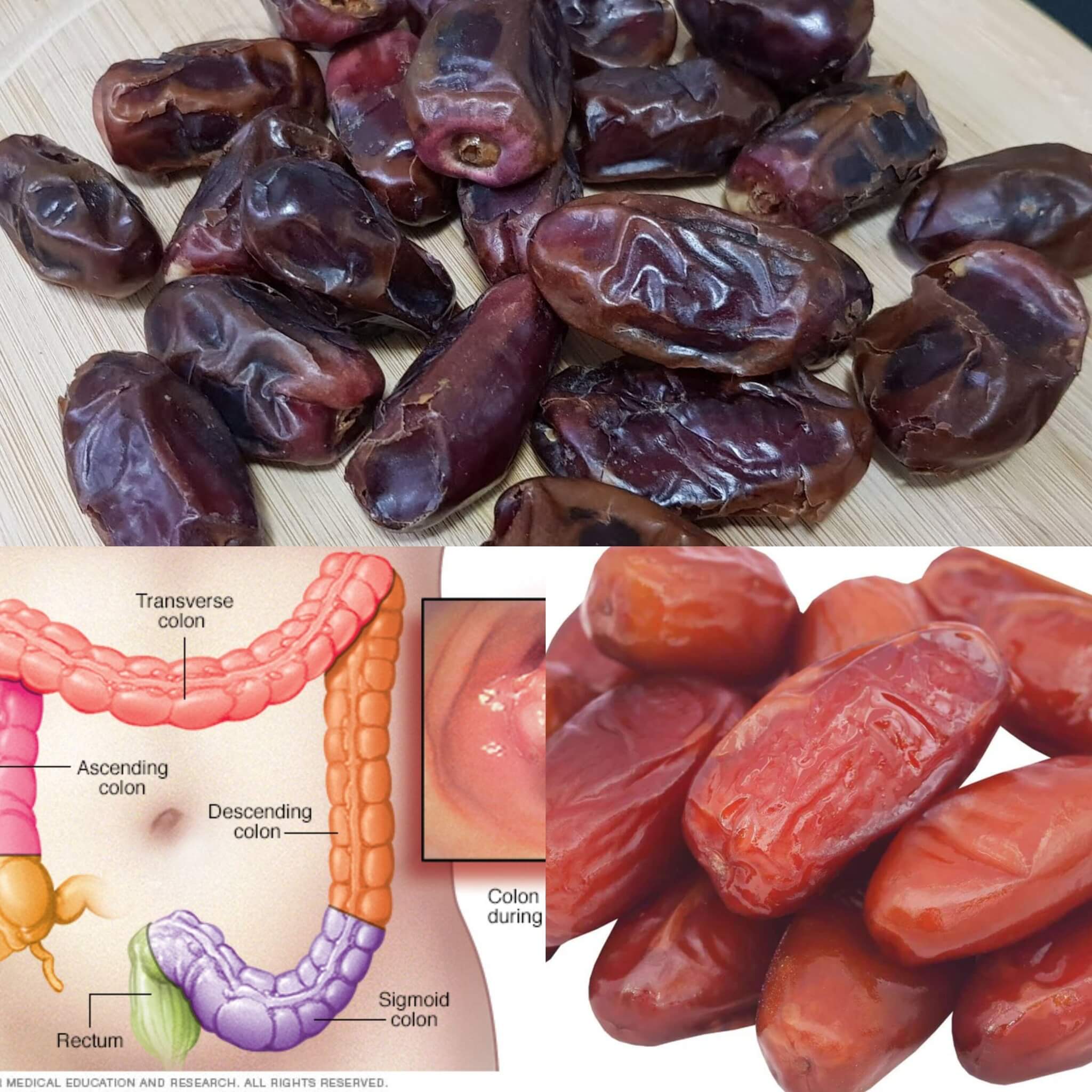 Using Dates to Cleanse Your Intestines: A Natural Detox Method 1