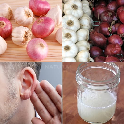 Garlic and Onion: Natural Remedies for Improving Hearing Loss 1
