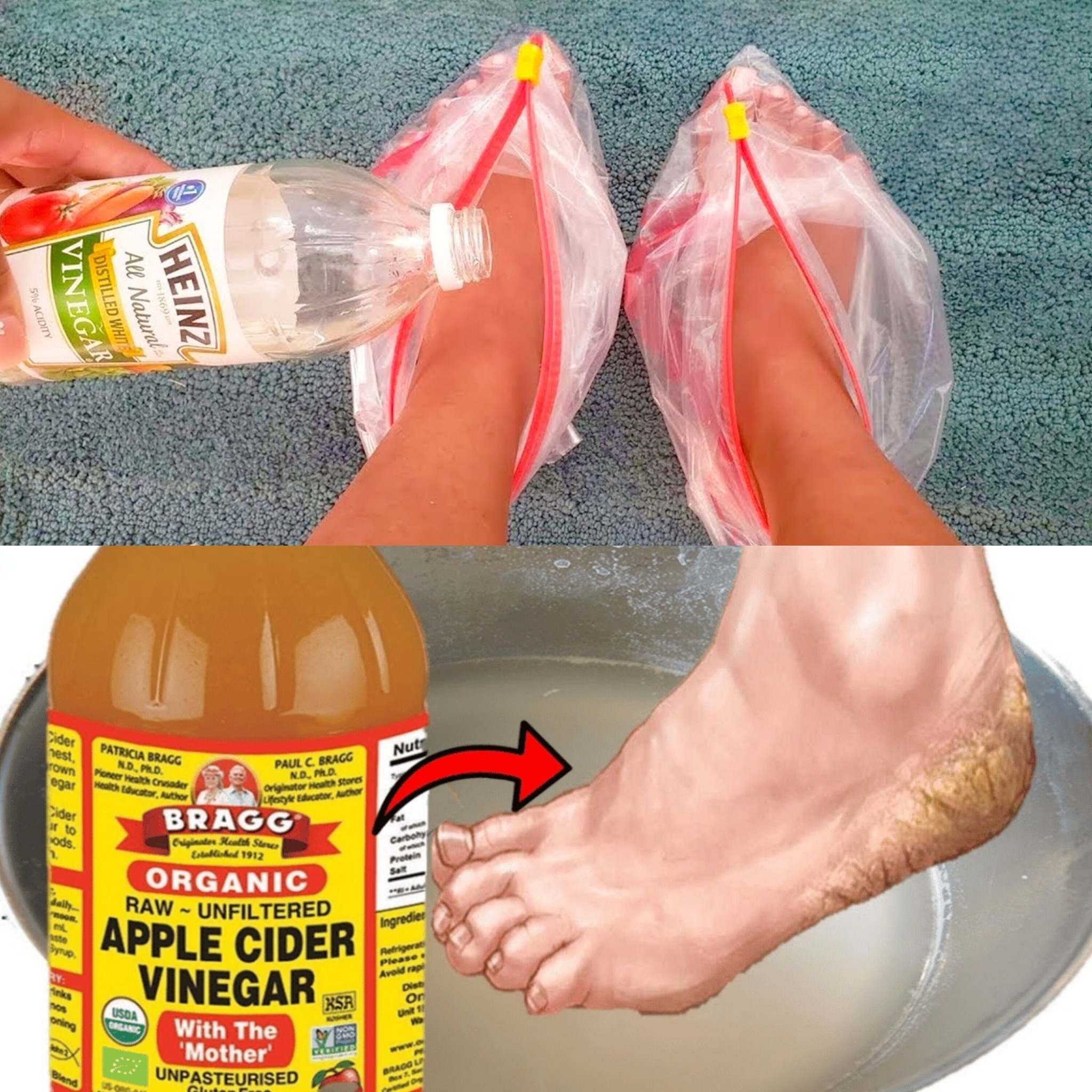 You won't believe what transpired when I put vinegar on my feet! 1