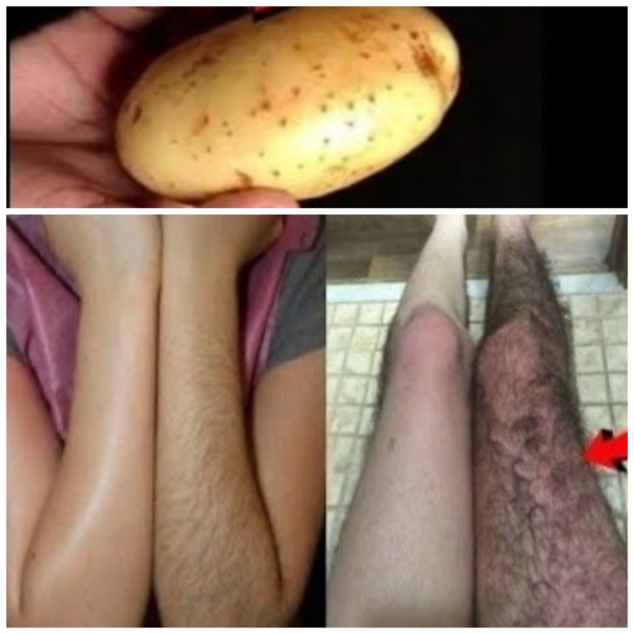 Easy and Natural Homemade Hair Removal Method 1