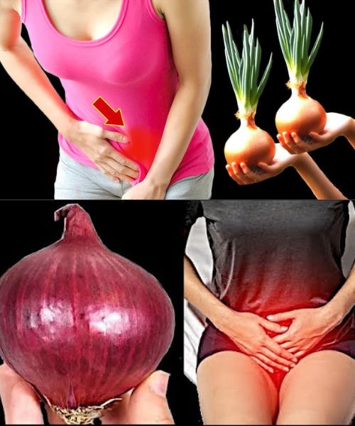 Onion: It Will Make Your Bladder and Prostate Look Like New! 1