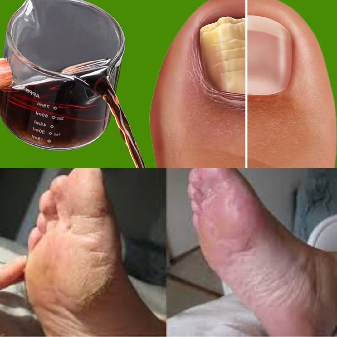 Use Vinegar to Get Healthy, Shiny Nails 1