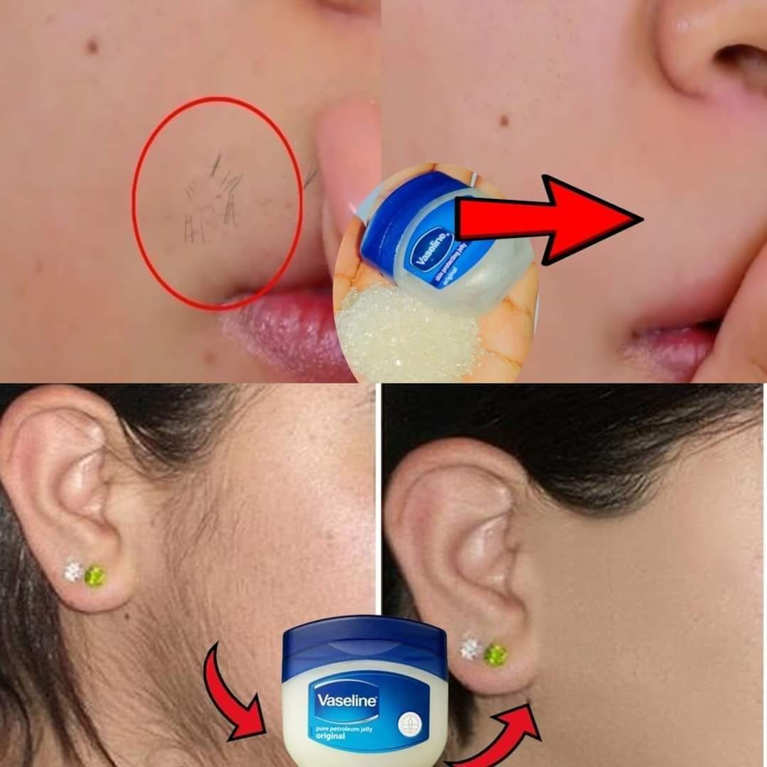 Vaseline for Upper Lip Hair Removal 1