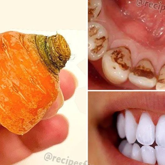 The Reasons Carrot Tops Help Whiten Teeth 1