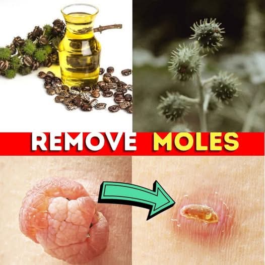 How to Remove a Mole Quickly Using Castor Oil 1
