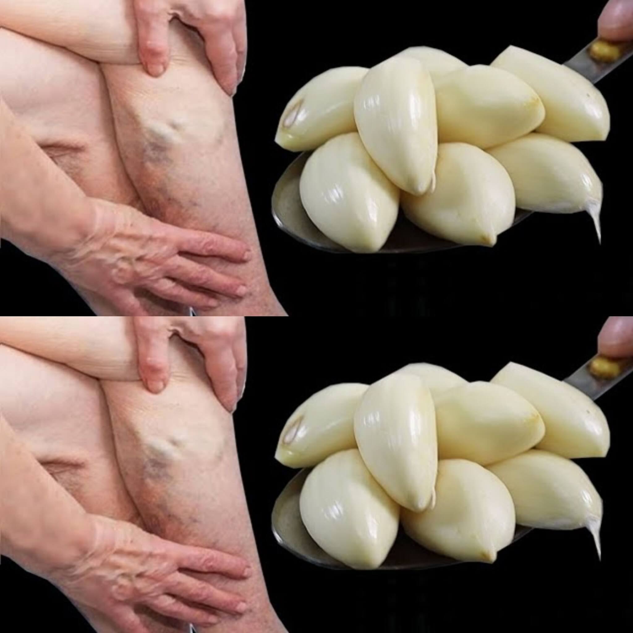 The Healing Power of Garlic and Black Pepper for Leg Pain 1