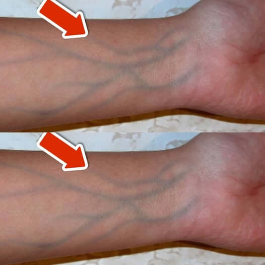 5 Signs of Poor Circulation You Should NEVER Ignore 1