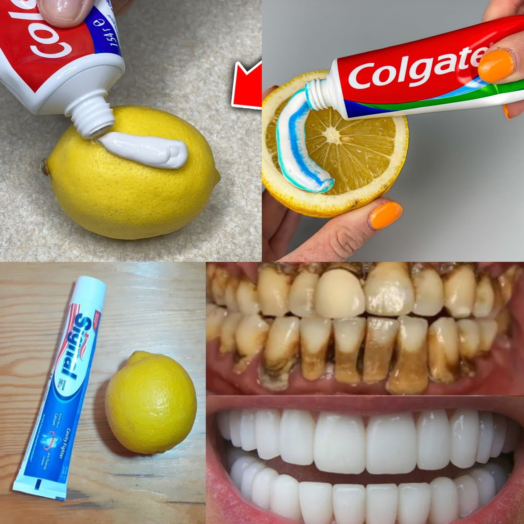 A Natural Concoction to Whiten Yellow Teeth in a Single Day at Home 1