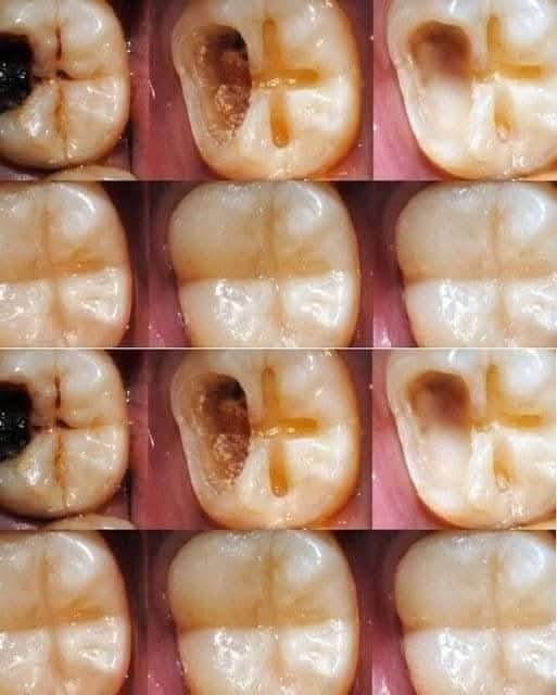 Natural Methods for Preserving Dental Health 1