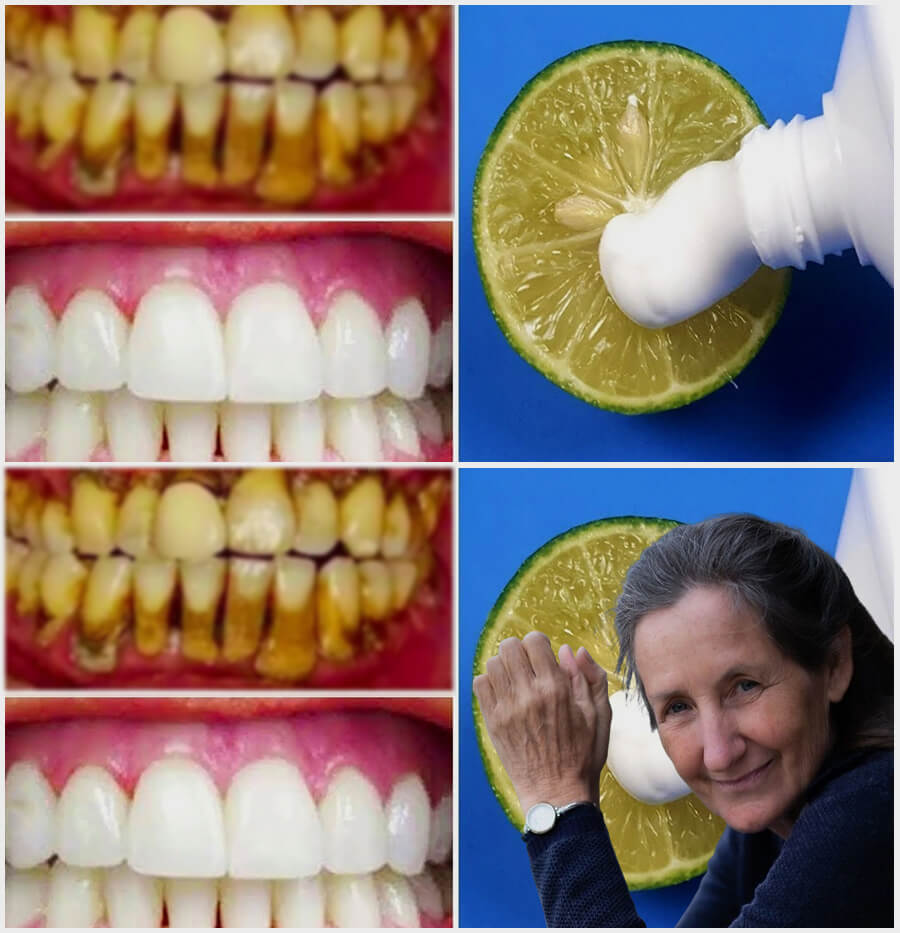 Within two minutes Use this technique to whiten your teeth naturally. 1
