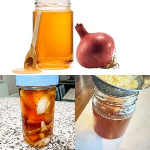 Onion and Honey Cough Syrup 1